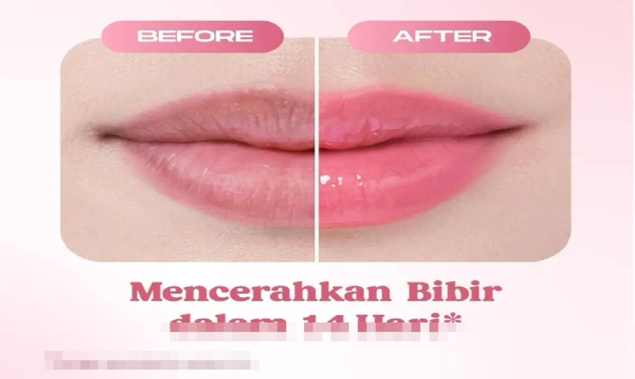 Ilustrasi bibir yang sudah cerah